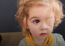 ''PRIMETILI SMO DA MU NEŠTO RASTE IZ OKA'' Poznanik poljubio dete u lice, usledio horor - roditelji, oprez! (FOTO)