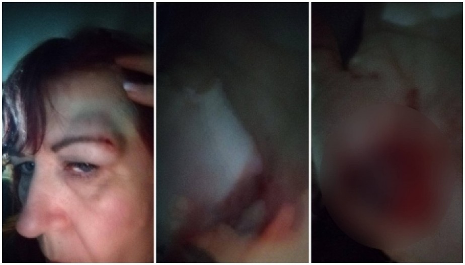 (UZNEMIRUJUĆE FOTOGRAFIJE) Danijelu Krstić pogodili kamenicom u glavu, pogledajte šta su divljaci uradili jednoj ženi u Nišu!