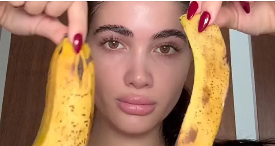 KORA OD BANANE KAO PRIRODNI BOTOKS?  Dermatolozi zgroženi trendom koji je zaludeo svet, upozoravaju šta se može desiti
