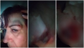 TUKLI SU I ŽENE, ZAMISLITE DA JE OVO BILA VAŠA MAJKA? Scene nasilja opozicije i blokadera u Nišu koje ne smeju da se ZABORAVE (FOTO/VIDEO)