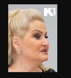 PEVAČICA NA METI KRITIKA ZBOG SVOG IZGLEDA! Ne želi više da ćuti, svi je napadaju zbog botoksa: "Ljudi misle da sam se izdeformisala.."