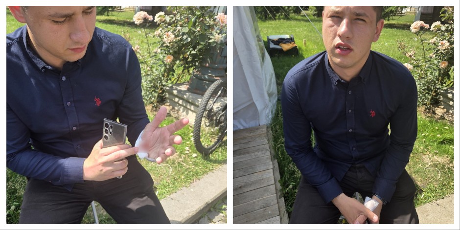 MILOŠ PAVLOVIĆ POKAZAO POVREDE! (FOTO/VIDEO)