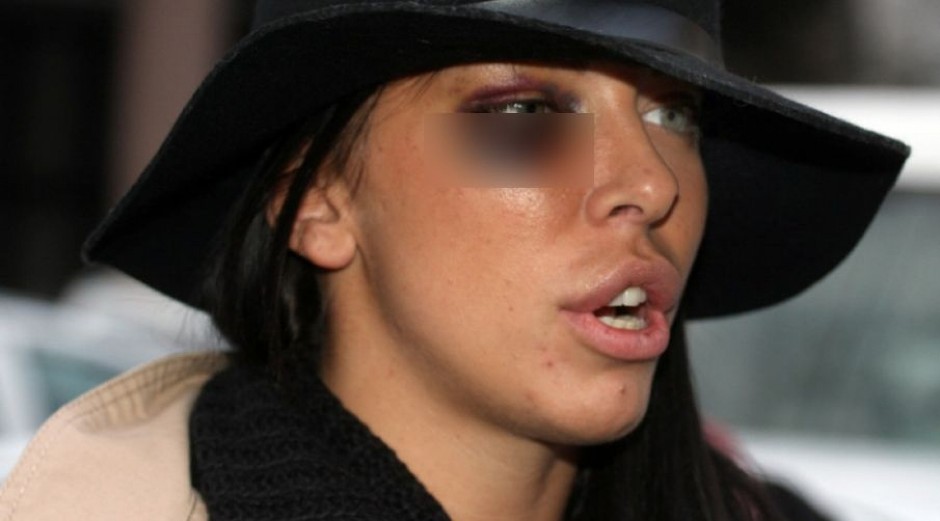 "POVREDE SU BILE JEZIVE" Voditelj nestao posle brutalnog prebijanja žene, ona deset godina čeka pravdu!