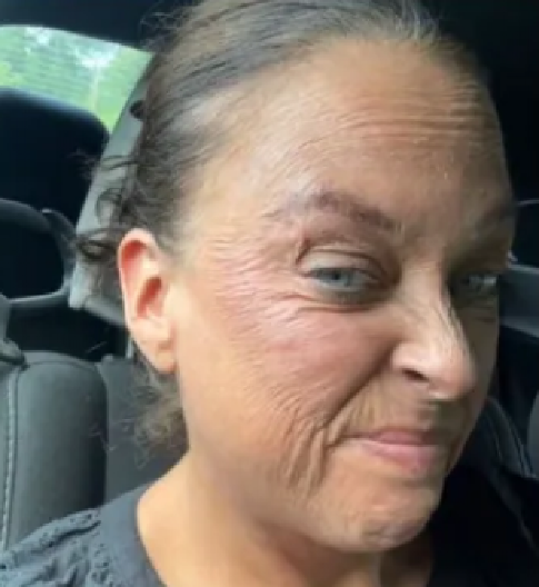 "IZGLEDAM KAO DA IMAM 80 GODINA"  Lisa odlepila za kozmetičkim preparatom, a cenu je platila njena lepota - "dobila sam rane i žuljeve!"