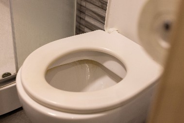 I NE, NISU SIRĆE I SODA BIKARBONA NEGO NEŠTO JOŠ MNOGO BOLJE Evo kako da očistite požutelu dasku od wc šolje, da ne biste morali da kupujete drugu