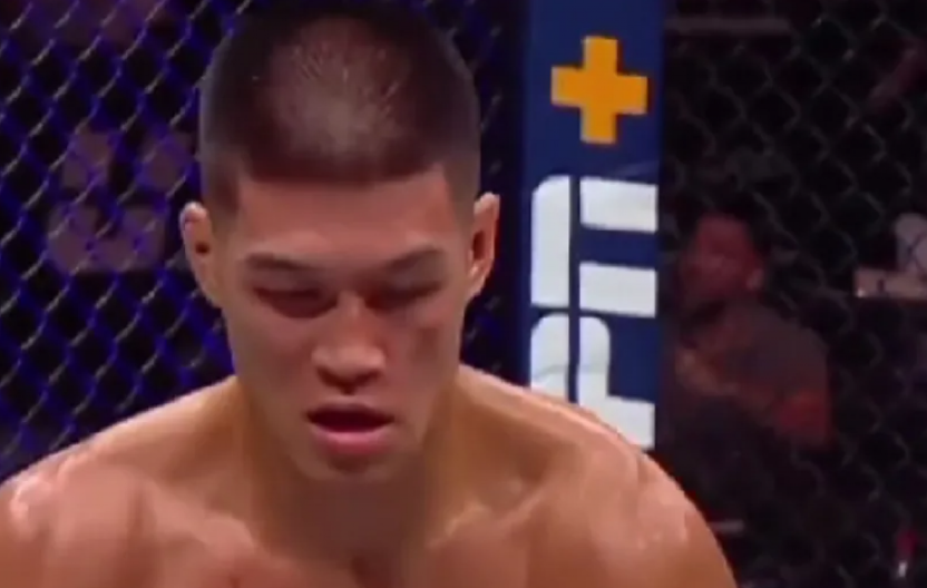 UZNEMIRUJUĆE Unakazio lice protivnika, pa ispisao nove stranice UFC-a, meč morao da se prekine