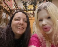 BUGARKA SA NAJVEĆIM USNAMA NA SVETU OTKRIVA ZAŠTO NE MOŽE DA STANE Pogledajte kako je Andrea Ivanova nekada izgledala pre estetskih operacija