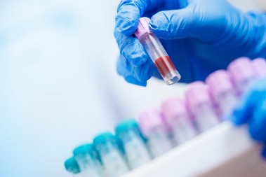 DECA NAJUGROŽENIJA, VIŠE OD 1.600 ZARAŽENIH! Opasan virus hara komšilukom, četvoro mrtvih!