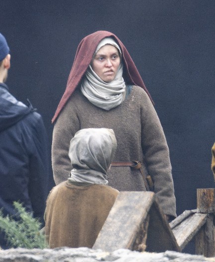 OŽILJAK NA USNI, ORONULO LICE, TUŽNE OČI Sam pogled na čuvenu glumicu budi jezu