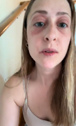 MORALA DA POBEGNE IZ SOPSTVENE KUĆE Devojka dobila ozbiljne zdravstvene probleme, za sve je kriva jedna stvar