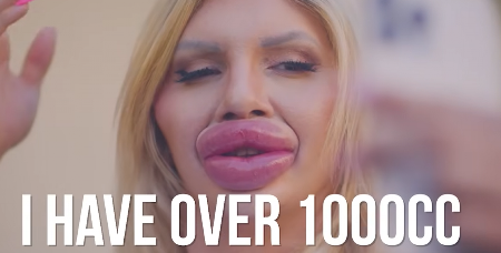 ZOVU JE FRANKENŠTAJN I KAŽU DA JE MAJKA MONSTRUM Evo kako izgleda devojka koja je uložila 42.000 evra da bi imala najveća usta na svetu (FOTO/VIDEO)