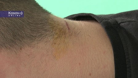 MONSTRUMI! Albanski policajci napali Vukašina zbog grba Srbije na nalepnici! "Vukli su ga, pretresali, šutirali!"