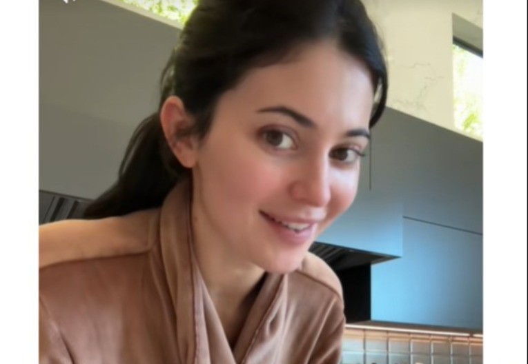 Kajli Džener opet napravila haos: Pokazala šta radi s licem zbog lepote, ljudi je masovno ismevaju!