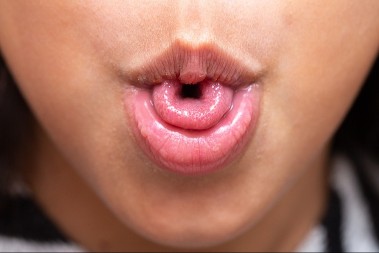 Možete li da savijete jezik u obliku slova ‘U’? Ovaj trik otkriva tajnu vašeg mozga – proverite da li spadate u genijalce!