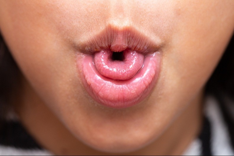 Možete li da savijete jezik u obliku slova ‘U’? Ovaj trik otkriva tajnu vašeg mozga – proverite da li spadate u genijalce!