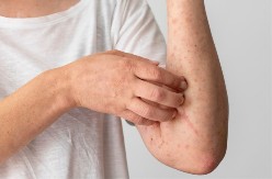 OD TOG SVRABA NE MOŽE DA SE SPAVA Pedijatar objasnio kako da se zaštitimo od opasne zarazne bolesti