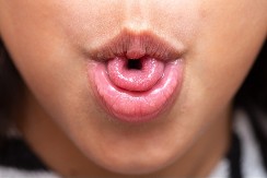 SAVIJATE JEZIK U OBLIKU SLOVA "U" I DETELINE? Evo šta psiholozi kažu za ljude koji to umeju