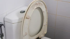 Iz sve snage trljate, ali se žutilo ne skida? Za fleke u WC šolji vam neće pomoći ni izbeljivač, samo ovaj sastojak skida sve kao od šale 