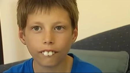 „Zvali su ga dečak zec i rugali mu se zbog zuba“: Pet godina kasnije Evan je pokazao osmeh koji je rasplakao mnoge