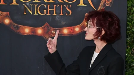 Zatezanje joj se obilo o glavu: Žena muzičke legende se pokajala zbog estetskog zahvata
