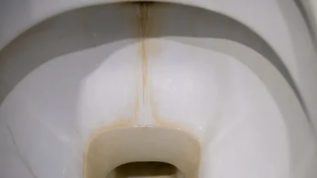Evo kako moja snajka sklanja kamenac sa dna WC šolje za sekund