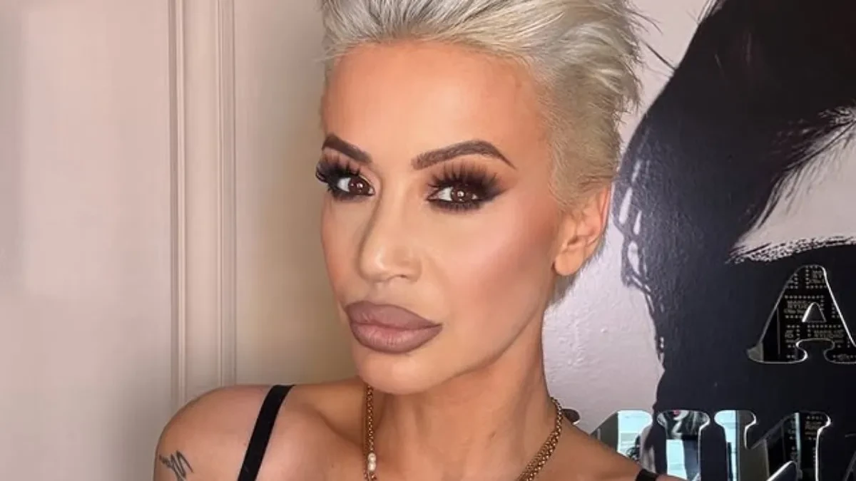 "Pao mi je vrh nosa" Dušica Jakovljević se hitno oglasila, lice joj u flasterima
