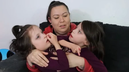 Lekari su majci rekli da su joj bebe spojene, a onda je usledio šok: Odbila je prekid trudnoće, danas njene ćerke imaju posebnu poruku za svet