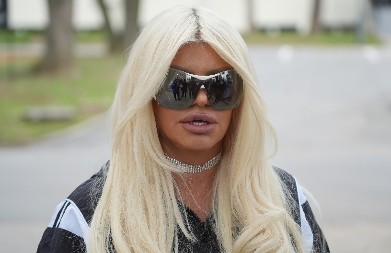 "ČESTO MENJAM SILIKONE" Dara Bubamara na korekcije dala skoro 30.000 evra, evo šta je sve radila na sebi 