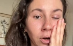 ''KAO DA MI NOŽEVI REŽU OKO'' Devojku napao jeziv PARAZIT - može da ostane bez vida! 