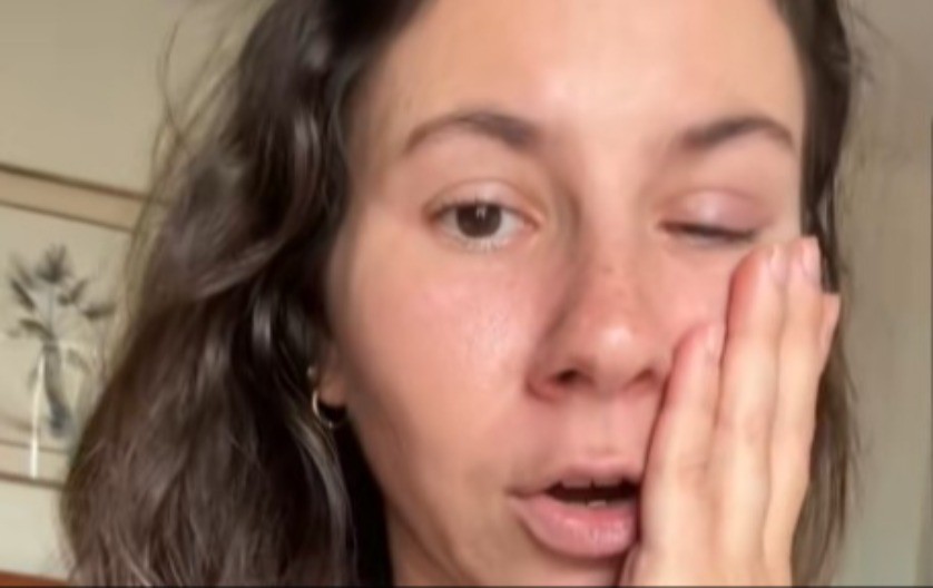 ''KAO DA MI NOŽEVI REŽU OKO'' Devojku napao jeziv PARAZIT - može da ostane bez vida! 