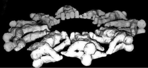 USTAŠE SU POKLALE 20 SRPSKIH DEČAKA I DEVOJČICA Postavili su ih u krug, jedno na drugo