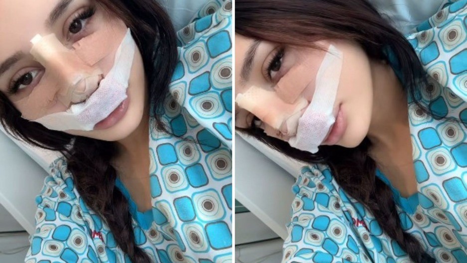 OPERISANA NINA ĐOGANI Oglasila se iz bolnice sva u zavojima 