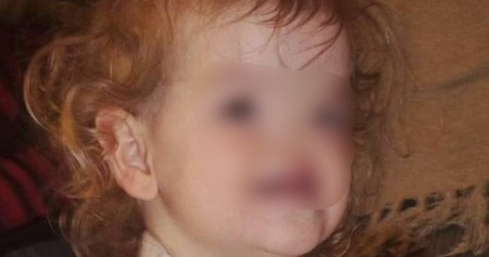 LEKARI ZANEMELI, MAJKA U SUZAMA: Beba rođena BEZ NOSA – danas joj se DIVI CEO SVET!