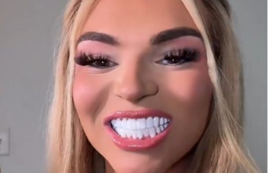 AU! Devojka nove zube platila kao GARSONJERU, ljudi na mrežama ZANEMELI kad su videli rezultat (VIDEO)