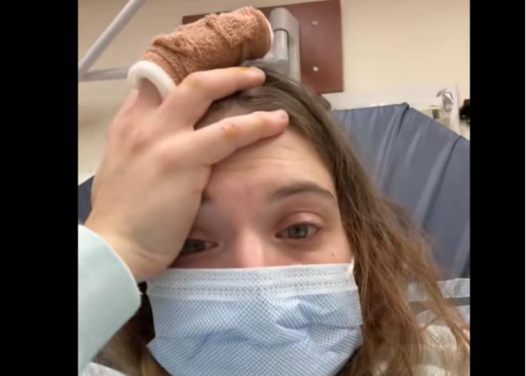 Gabi godinama ima ovu naviku, baš kao i većina Srba: Prst joj je preko noći pocrneo, umalo ostala bez njega