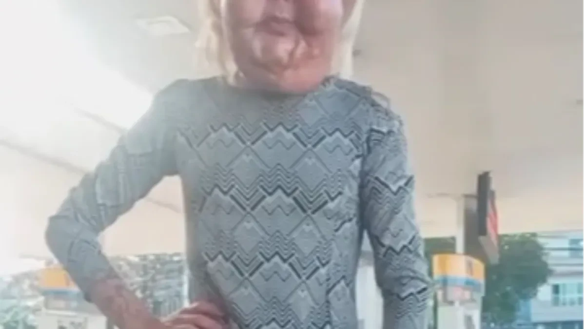 DA LI JE PREPOZNAJETE? Popularna influenserka izobličena nakon plastične operacije! (FOTO)