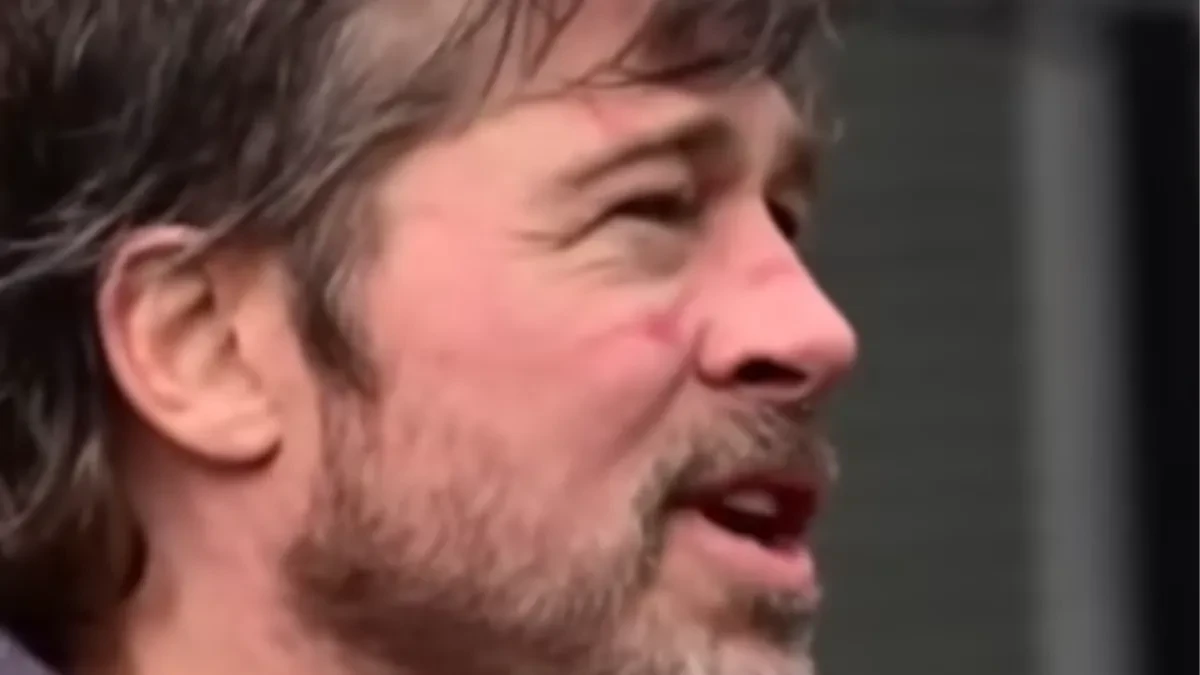 HOLIVUDSKOG LEPOTANA NIKO NE MOŽE DA PREPOZNA Natečen je, u modricama i zapušten - svi se pitaju šta mu se desilo