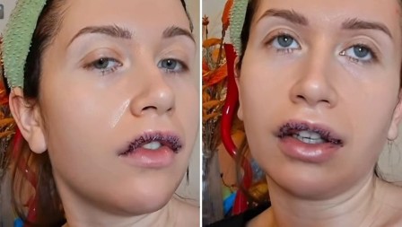 OPERISANA NAŠA PEVAČICA Otkriveno u kakvom je stanju: "Devojke, nemojte oklevati" 