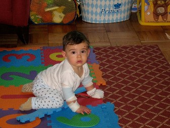 U SRBIJI 41 OSOBA SA OBOLJENJEM "DECA LEPTIRI" Među prvima u Evropi imaju genski lek