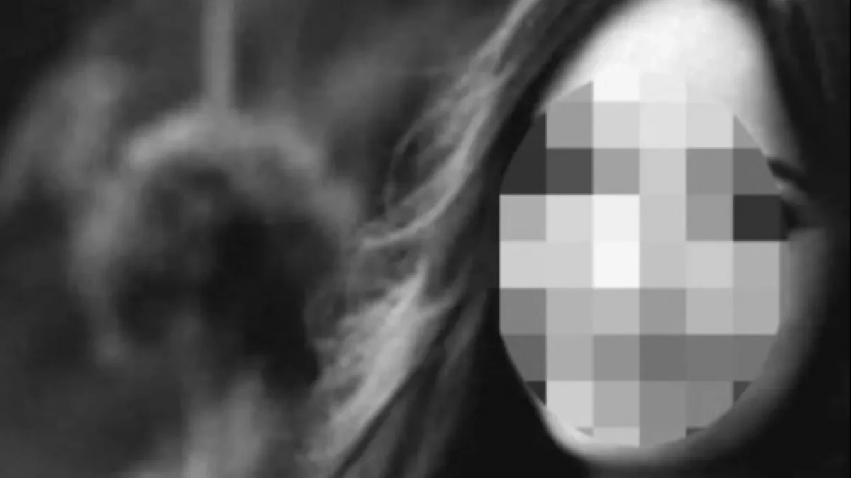 OVO JE DEVOJČICA KOJA JE POGINULA U SUDARU TROTINETA I "GOLFA" Novi Pazar tuguje, bila omijena u školi (FOTO)