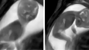 ŠTA SE ZAISTA DEŠAVA U STOMAKU? Snimak pokreta bebe zaludeo milione mama na internetu