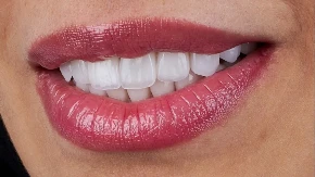 EVO KAKO DA PRIRODNO IZBELITE ZUBE Potrebne su vam OVE namirnice - zaboravite na skupe preparate