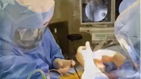 HIRURG PACIJENTU IZVADIO JETRU UMESTO SLEZINE Horor na operacionom stolu