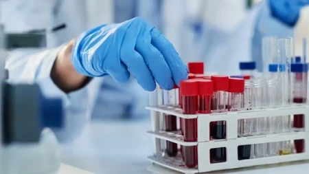 ALARM U VAREŠU: Olovo u krvi kod svih testiranih građana