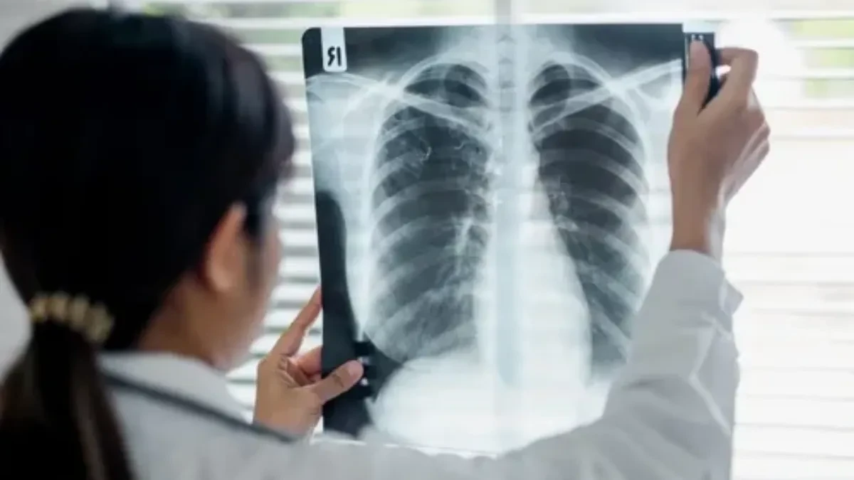 PUCKETANJE U PLUĆIMA! Registrovana nova bolest zbog vejpa!