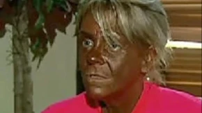 UNIŠTILA SE ZBOG TENA! Vodila dete u solarijum, a onda doživela PAKAO - danas izgleda JEZIVO 