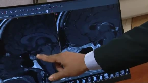 MISLILA DA JE DO STRESA Česti simptomi krili su opaku bolest, a ona kaže da je ovo bio najgori deo