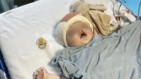 Babica pretrnula na porođaju, otac počeo da vrišti: Luka je četiri meseca imao zašivene oči, ali najteže tek dolazi