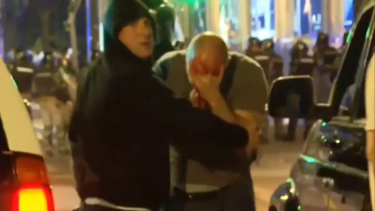 Jezivo: Osvanuo snimak policajca kojem su studenti razbili glavu