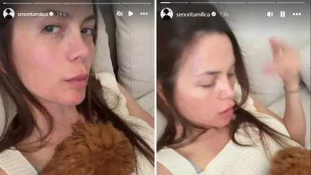 Milica Pavlović sva u ogrebotinama i crvenilu! Svi se ptiaju šta se desilo pevačici 